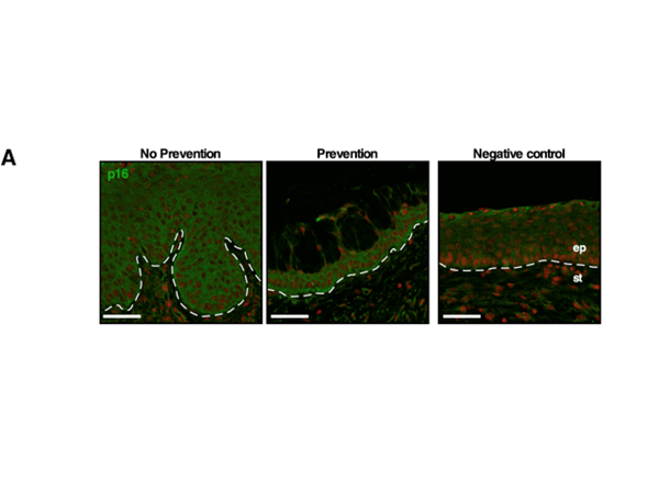 Immunofluorescence using CDKN2A