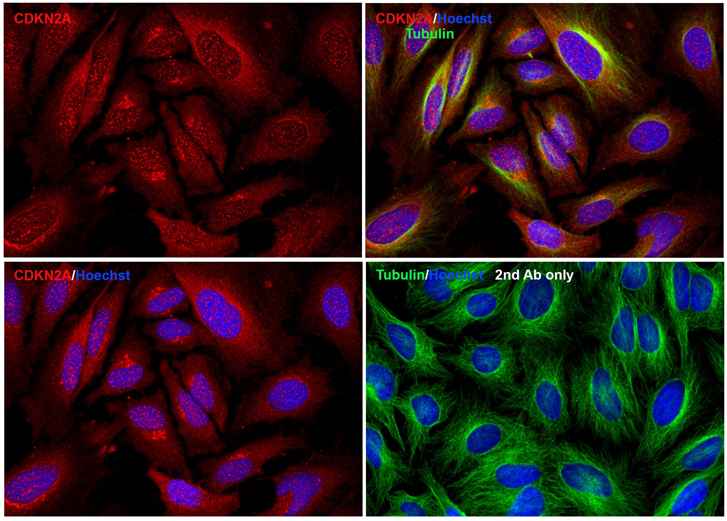 Immunofluorescence Validation of CDKN2A