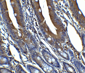 Immunohistochemistry Validation of CDKN2A