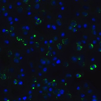 Immunofluorescence Validation of CDKN2A