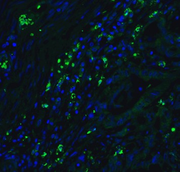 Immunofluorescence Validation of CDKN2A