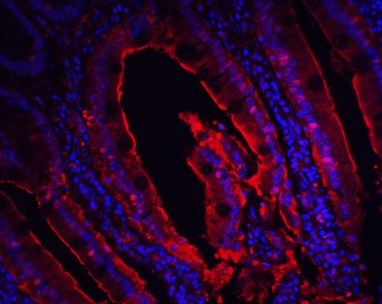 Immunohistochemistry Validation of CDKN2A