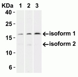 Western Blot using CDKN2A