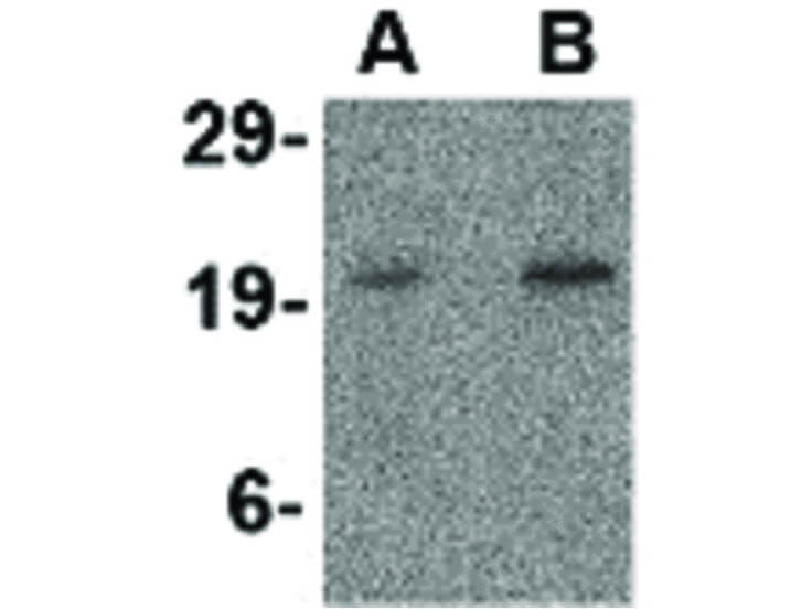 Western Blot of CDKN2A Antibody