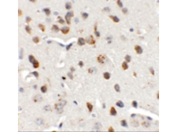 Immunohistochemistry of CHD7