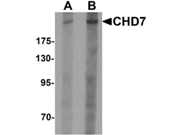 Western blot analysis of CHD7