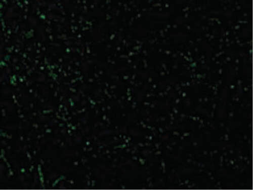 Immunofluorescence of CIDE-A Antibody