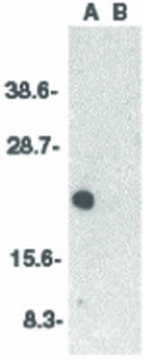 Western Blot of CIDE-A Antibody