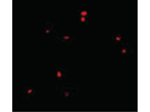 Immunofluorescence of CIDE-B Antibody