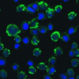 Immunofluorescence of CIKS