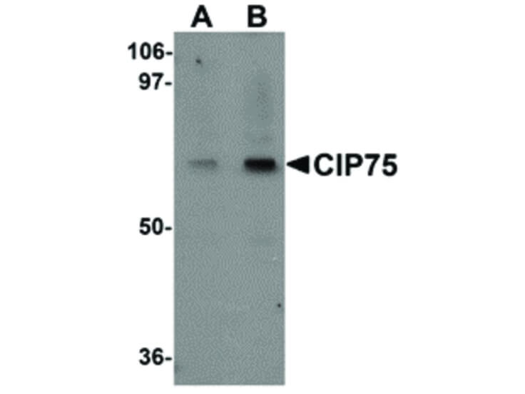 Western Blot of CIP75 Antibody