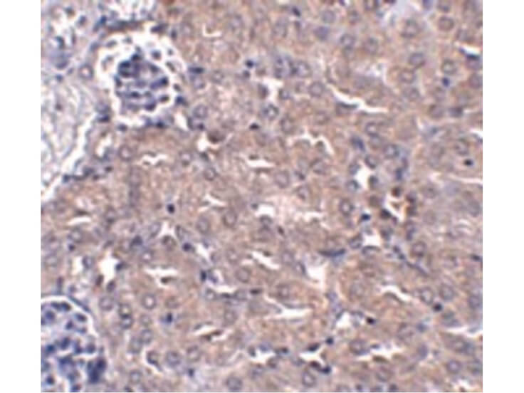 Immunohistochemistry of CIP75 Antibody