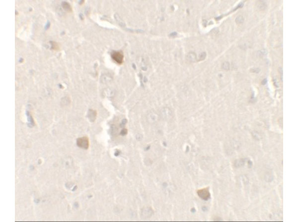 Immunohistochemistry of CISD2