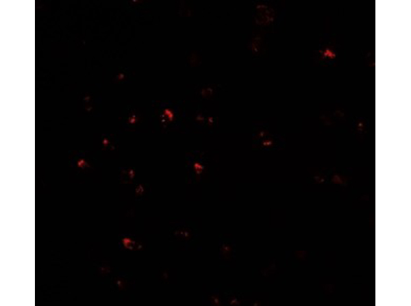Immunofluorescence of CITED2