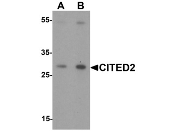 Western blot analysis of CITED2