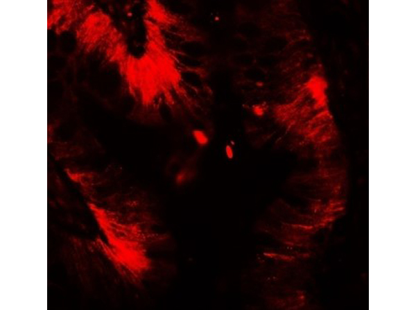Immunofluorescence of Claudin 4