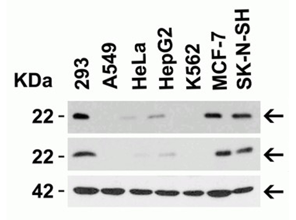 Western blot analysis of Claudin 4
