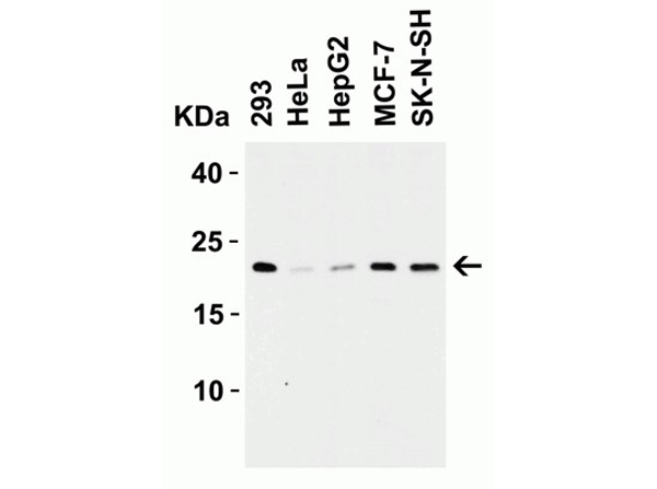 Western Blot analysis of Claudin 4
