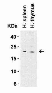 Western Blot using CLDN1