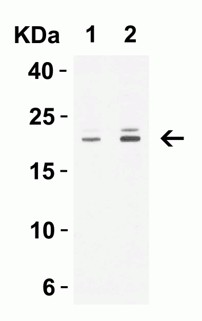 Western Blot using CLDN1