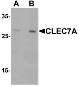 Western blot analysis of CLEC7A
