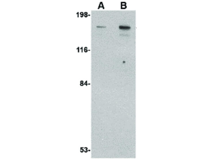 Western Blot of CLIP170 Antibody