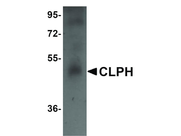 Western Blot of CLPH Antibody