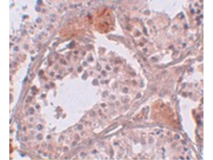 Immunohistochemistry of CLPH Antibody