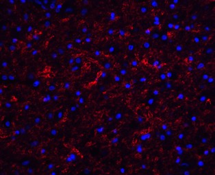 Immunofluorescence of Clusterin