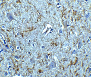 Immunohistochemistry of Clusterin