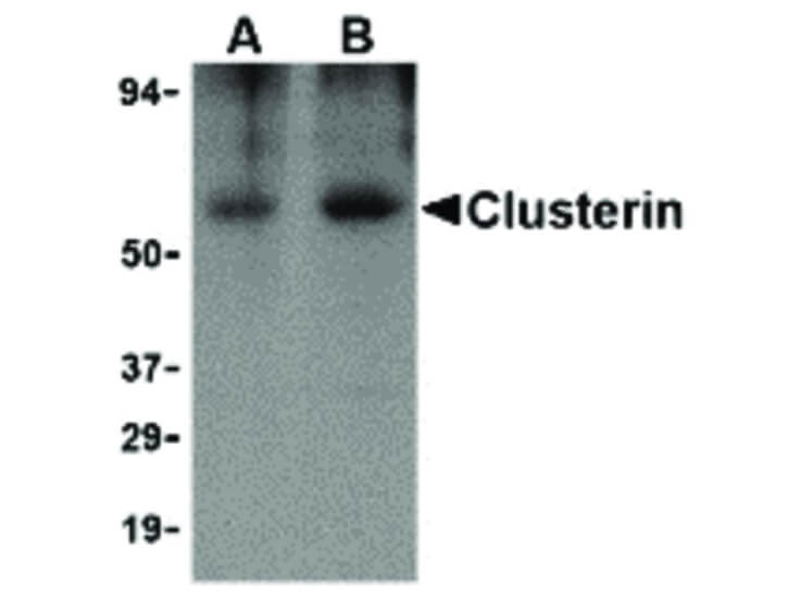 Western Blot of Clusterin Antibody