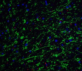 Immunofluorescence of Clusterin