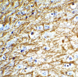 Immunohistochemistry of Clusterin