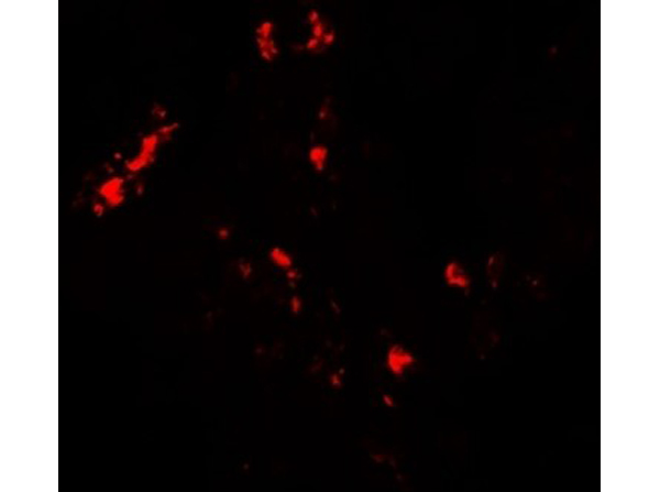Immunofluorescence of CMPK2