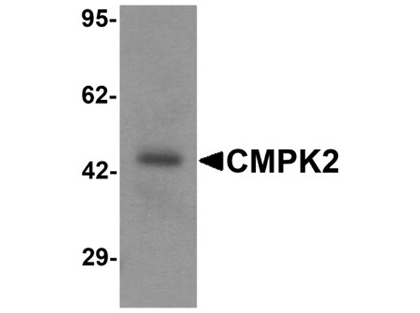 Western blot analysis of CMPK2