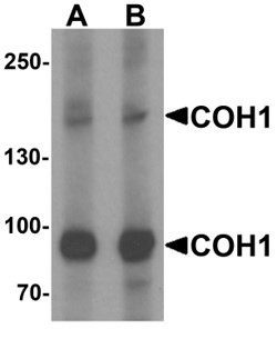 Western blot analysis of COH1.