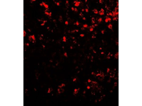 Immunofluorescence of COMMD7