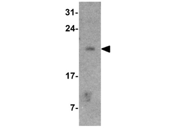 Western blot of COMMD7