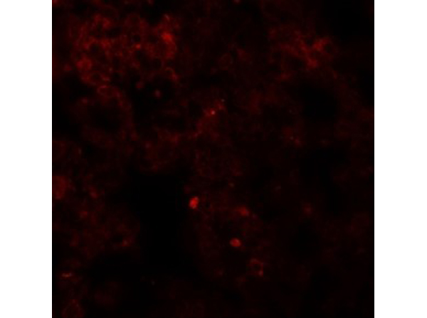 Immunofluorescence of Coronin 7