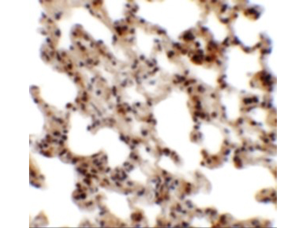 Immunohistochemistry of Coronin 7