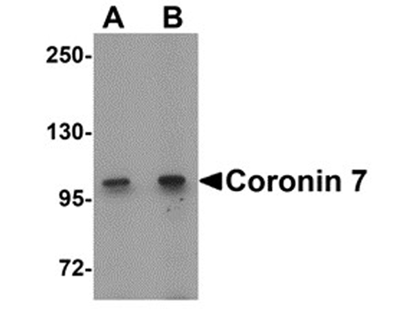 Western blot analysis of Coronin 7