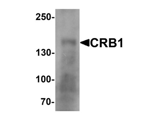 Western blot analysis of CRB1