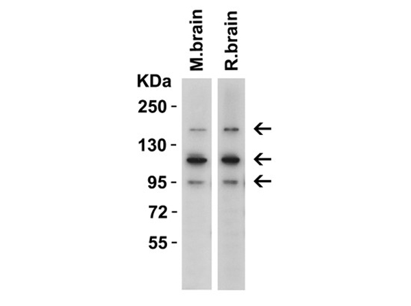 Western Blot of CRB2