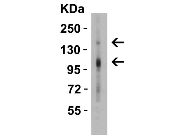 Western Blot of CRB2