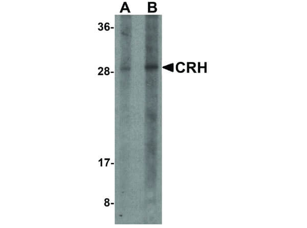Western Blot of CRH Antibody