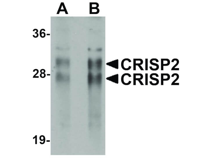 Western Blot of CRISP2 Antibody