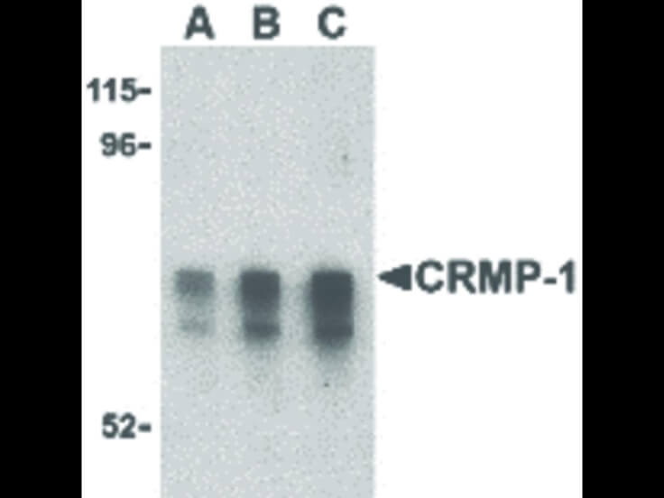Western Blot of CRMP1 Antibody
