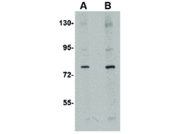 Western Blot of CRMP1 Antibody