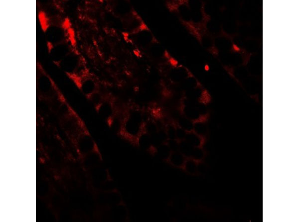 Immunofluorescence of CRTC2