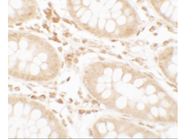 Immunohistochemistry of CRTC2